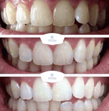 Load image into Gallery viewer, SISTEMA EM CASA SNOW TEETH WHITENING™ [‘KIT’ COMPLETO]
