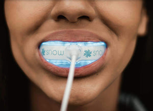 Snow® Teeth Whitening At-Home System [All-in-One Kit] - $99