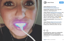 Load image into Gallery viewer, SNOW TEETH WHITENING™ SYSTÈME À DOMICILE [KIT TOUT-EN-UN]
