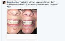 Load image into Gallery viewer, Special Offer - SNOW Teeth Whitening™ System
