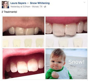 Special Offer - SNOW Teeth Whitening™ System